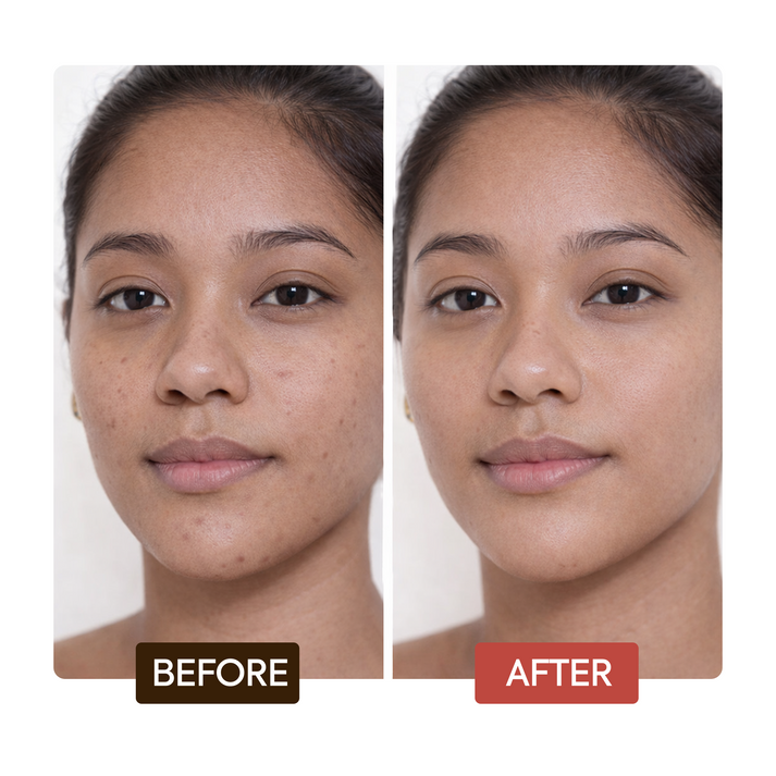 Makari Naturalle Intense Extreme soap bar with before and after skin transformation images showing improved skin tone.